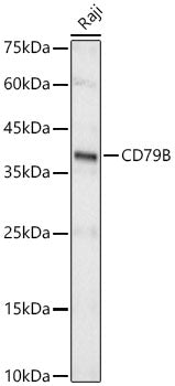 CD79B Rabbit mAb