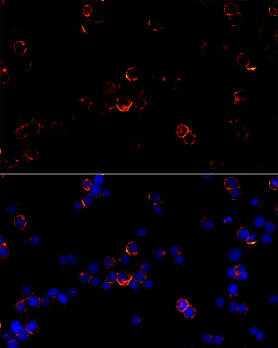 CD79B Rabbit mAb
