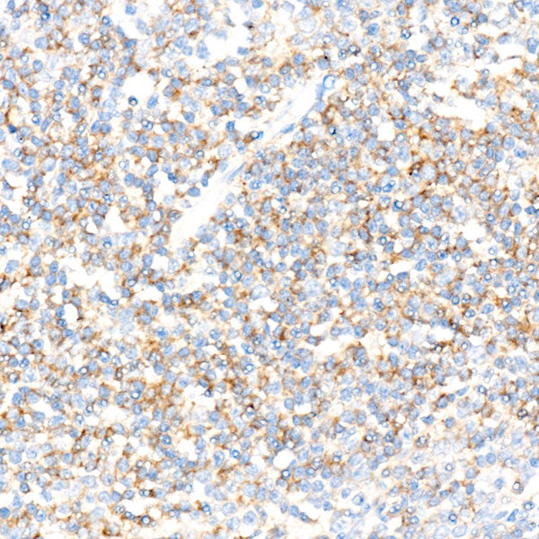 CD72 Rabbit mAb