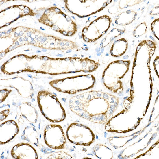 BCAT2 Rabbit mAb