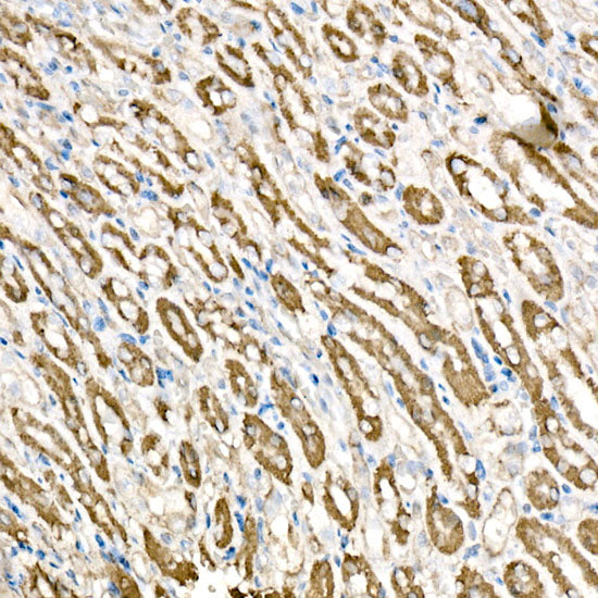 BCAT2 Rabbit mAb
