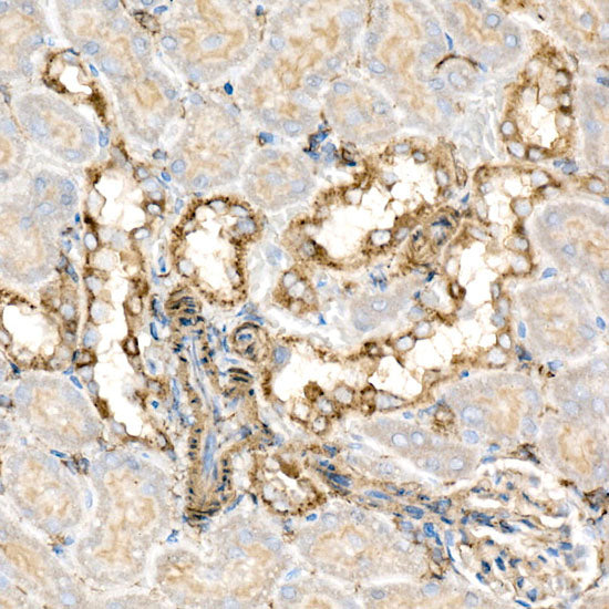BCAT2 Rabbit mAb