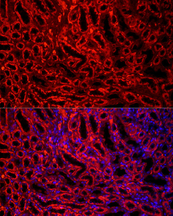 BCAT2 Rabbit mAb