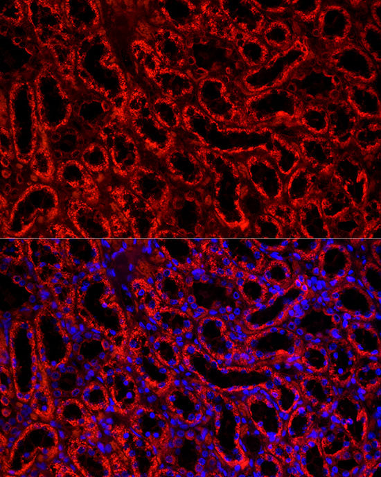 BCAT2 Rabbit mAb