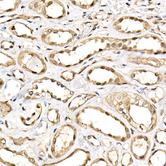 DDX3X/DDX3Y Rabbit mAb