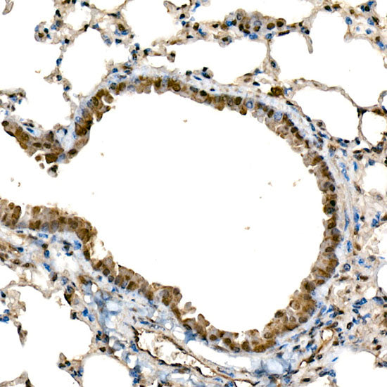 DDX3X/DDX3Y Rabbit mAb