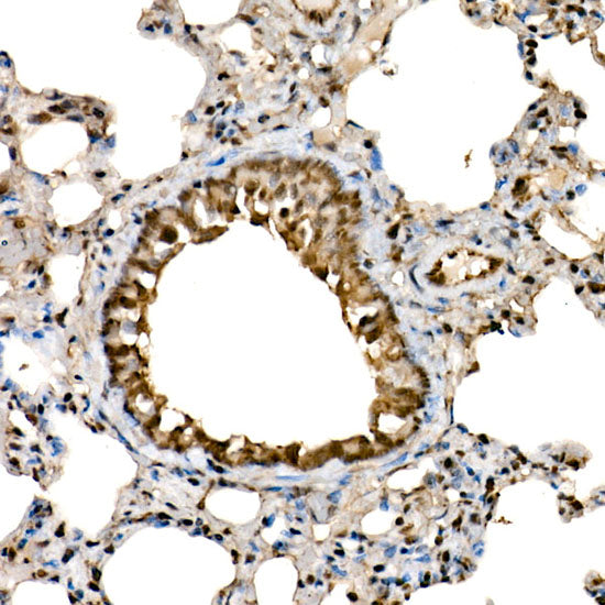 DDX3X/DDX3Y Rabbit mAb