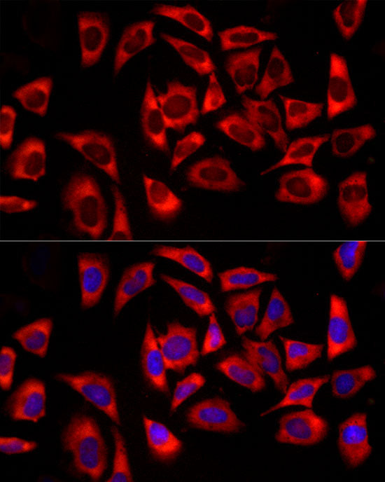 DDX3X/DDX3Y Rabbit mAb