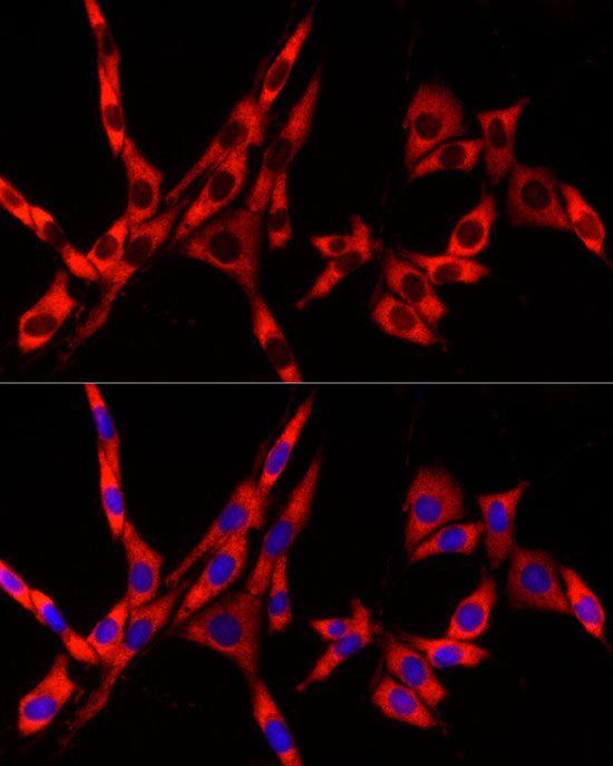 DDX3X/DDX3Y Rabbit mAb