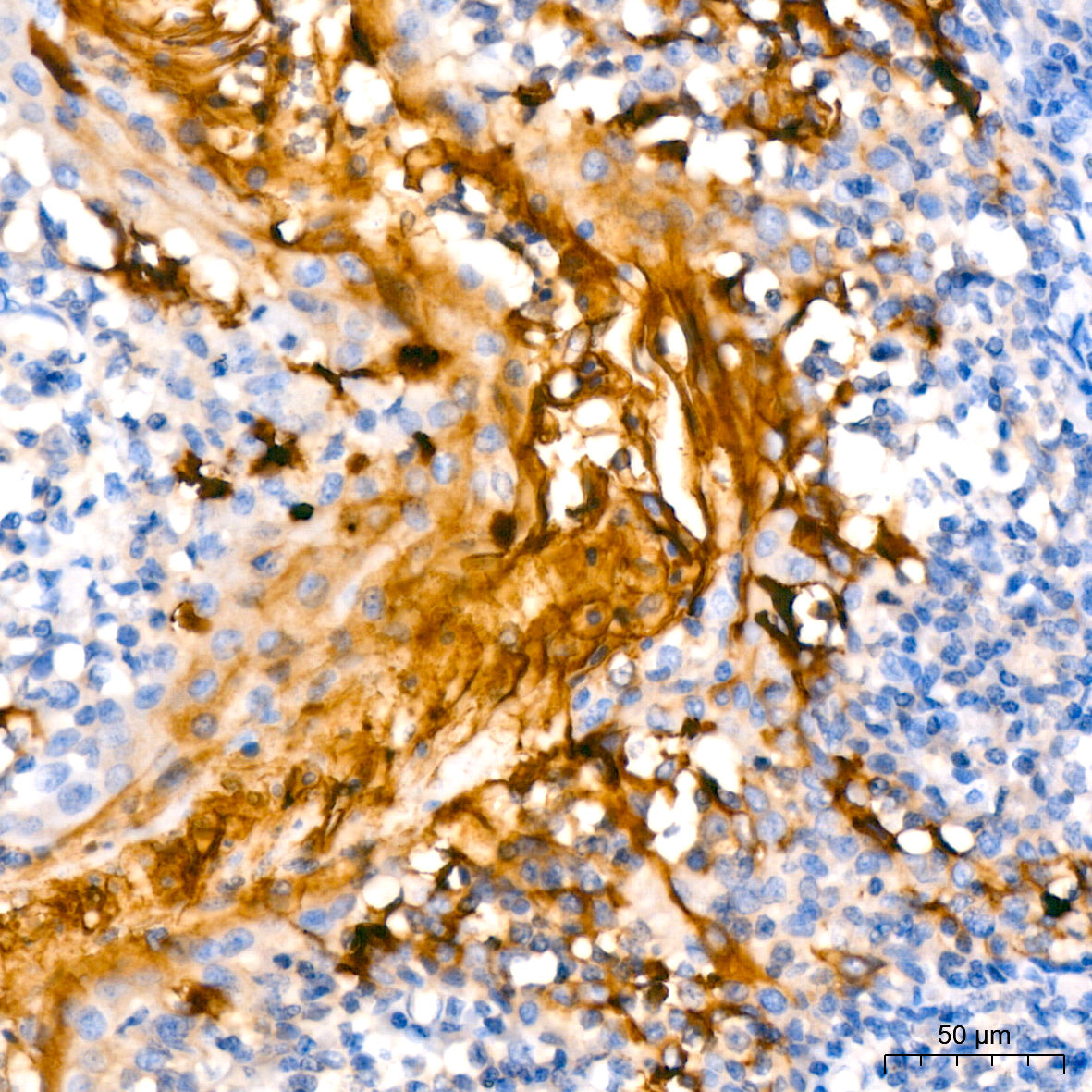 Mesothelin Rabbit mAb