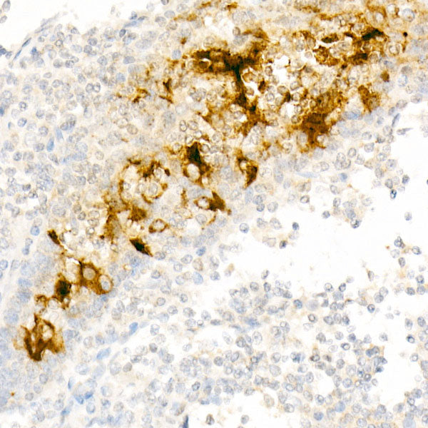 Mesothelin Rabbit mAb