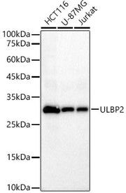 ULBP2 Rabbit mAb