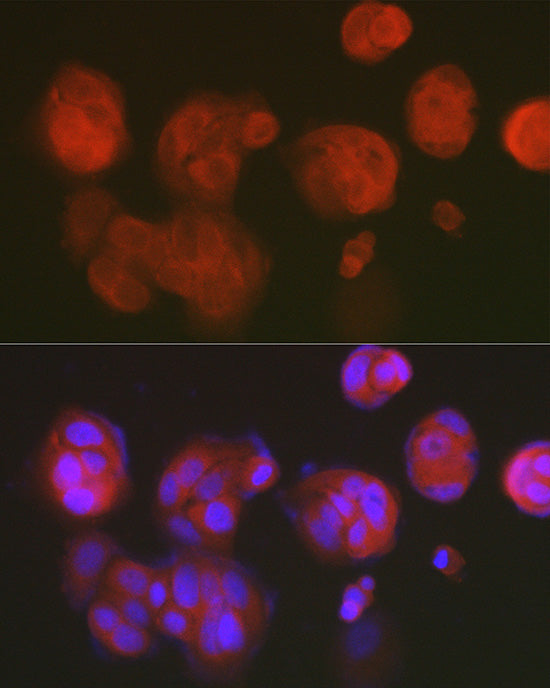 DNPH1 Rabbit mAb