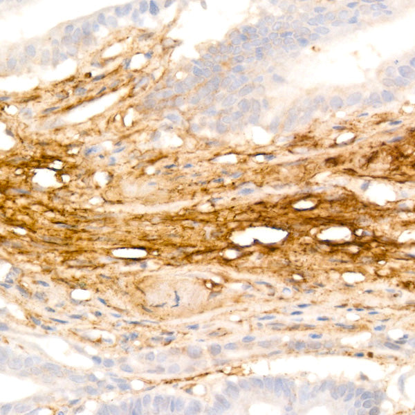 Fibronectin Rabbit mAb
