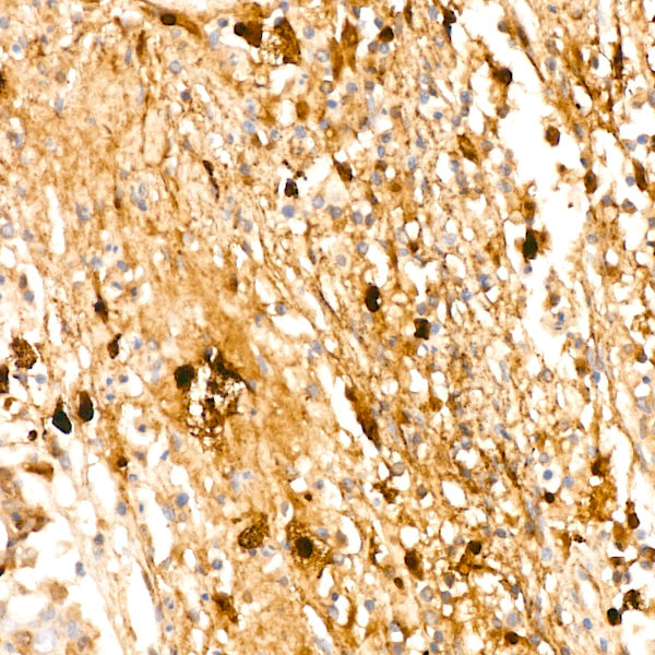 Fibronectin Rabbit mAb