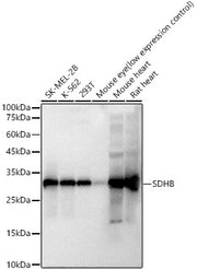 SDHB Rabbit mAb