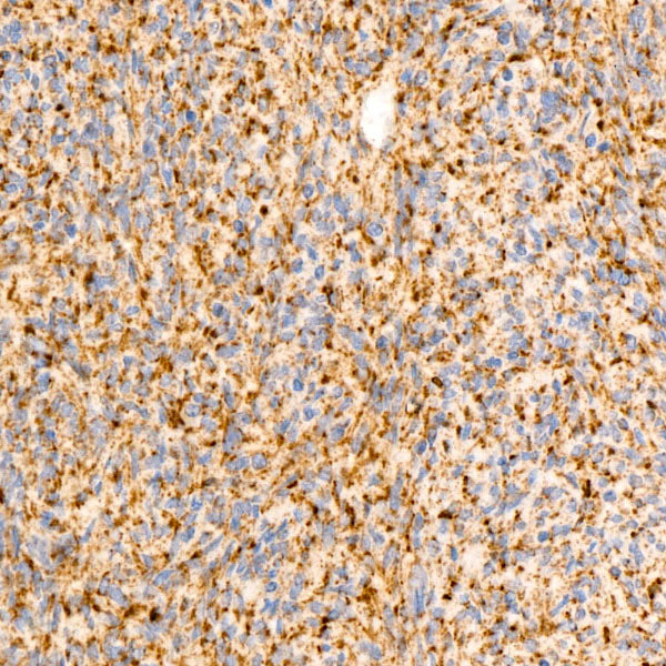 SDHB Rabbit mAb