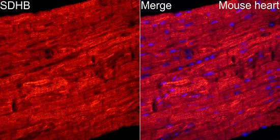 SDHB Rabbit mAb