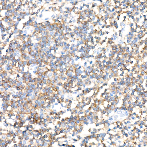 CD352/SLAMF6 Rabbit mAb