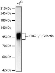 CD62E/E-Selectin Rabbit mAb
