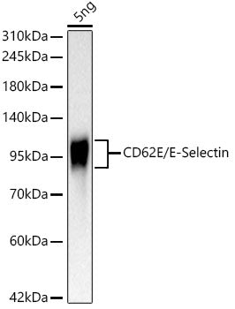 CD62E/E-Selectin Rabbit mAb