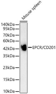 EPCR/CD201 Rabbit mAb