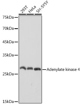 Adenylate kinase 4 Rabbit mAb