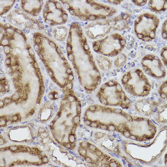 Adenylate kinase 4 Rabbit mAb