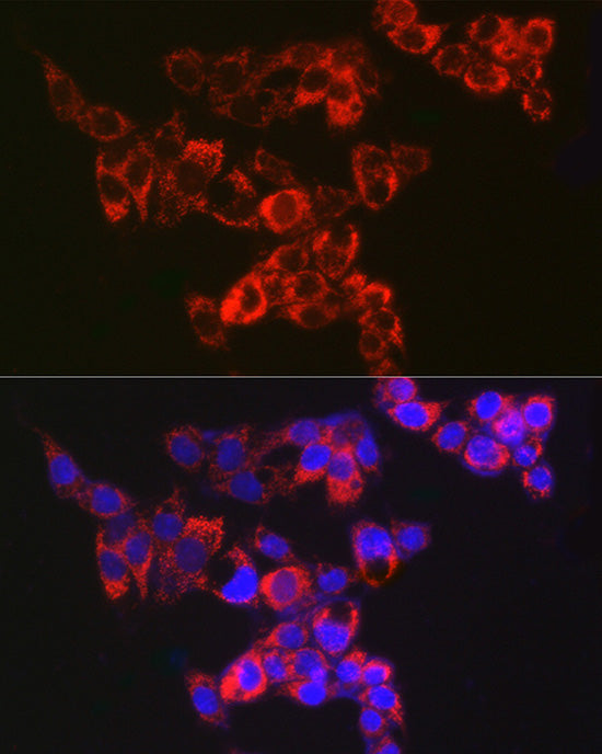 Adenylate kinase 4 Rabbit mAb