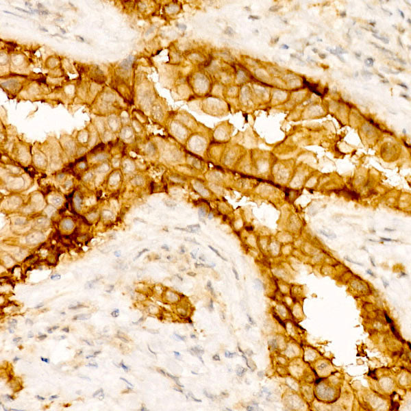 Claudin-4 Rabbit mAb
