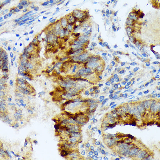 LEFTY1/2 Rabbit mAb