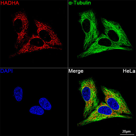 [KO Validated] HADHA Rabbit mAb