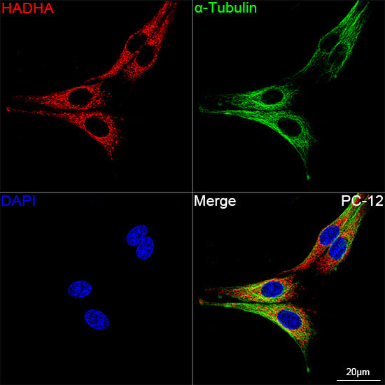 [KO Validated] HADHA Rabbit mAb