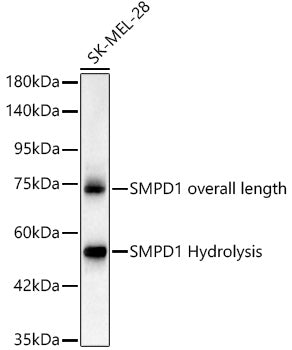[KO Validated] SMPD1 Rabbit mAb