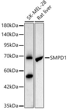 [KO Validated] SMPD1 Rabbit mAb