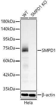 [KO Validated] SMPD1 Rabbit mAb
