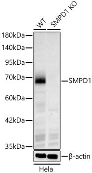 [KO Validated] SMPD1 Rabbit mAb