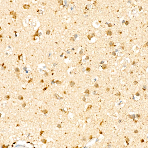 [KO Validated] SMPD1 Rabbit mAb