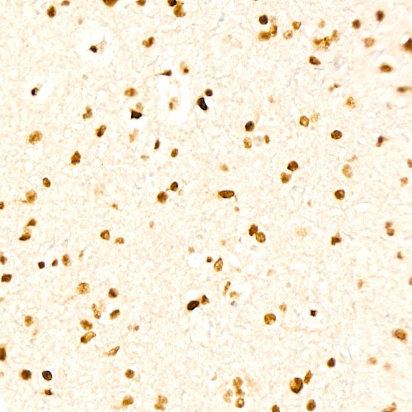 HSF1 Rabbit mAb