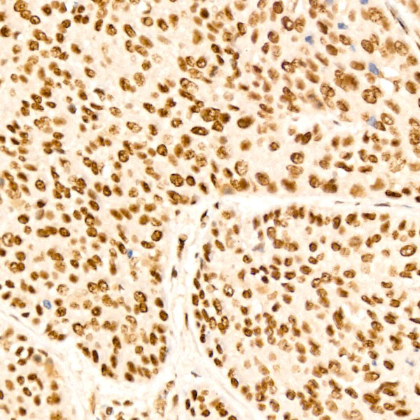 HSF1 Rabbit mAb