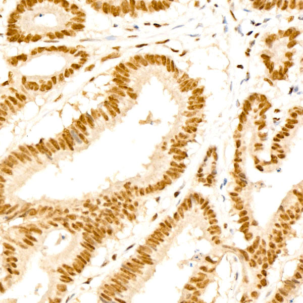 HSF1 Rabbit mAb