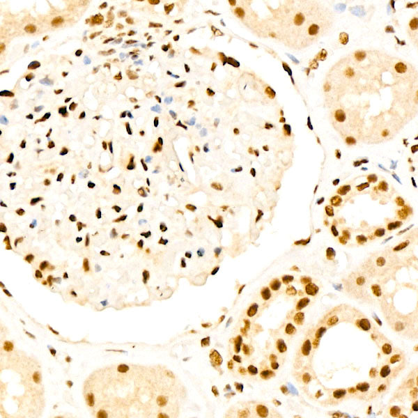 HSF1 Rabbit mAb