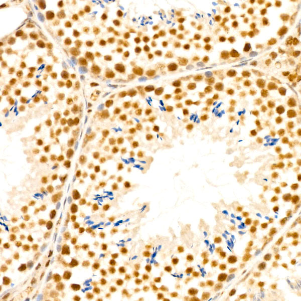 HSF1 Rabbit mAb