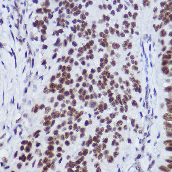 USP39 Rabbit mAb