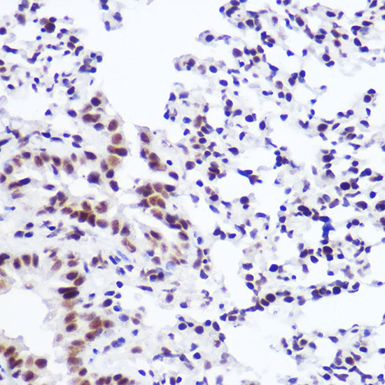 USP39 Rabbit mAb