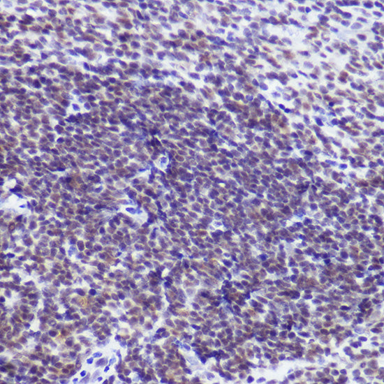 USP39 Rabbit mAb