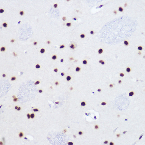 USP39 Rabbit mAb