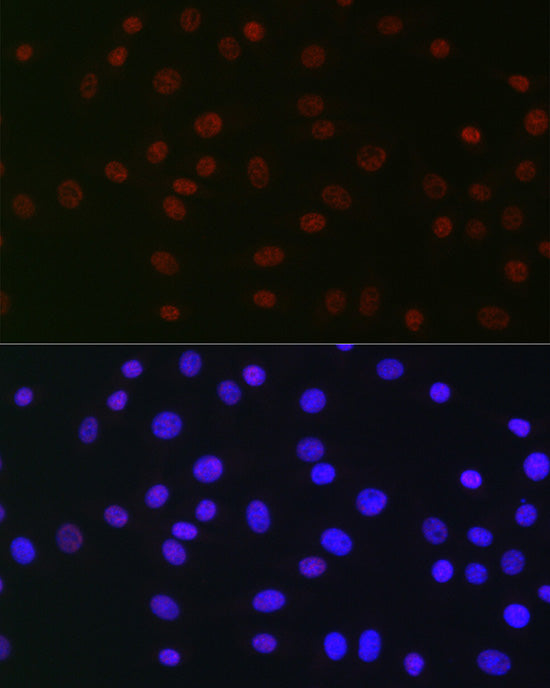USP39 Rabbit mAb