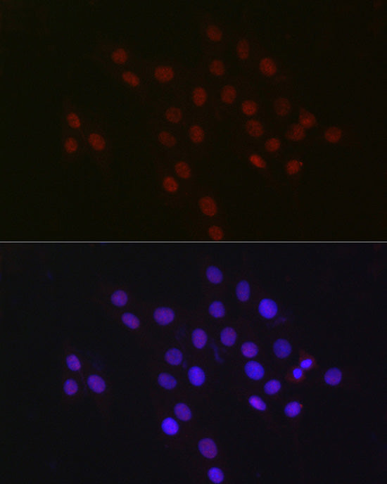 USP39 Rabbit mAb
