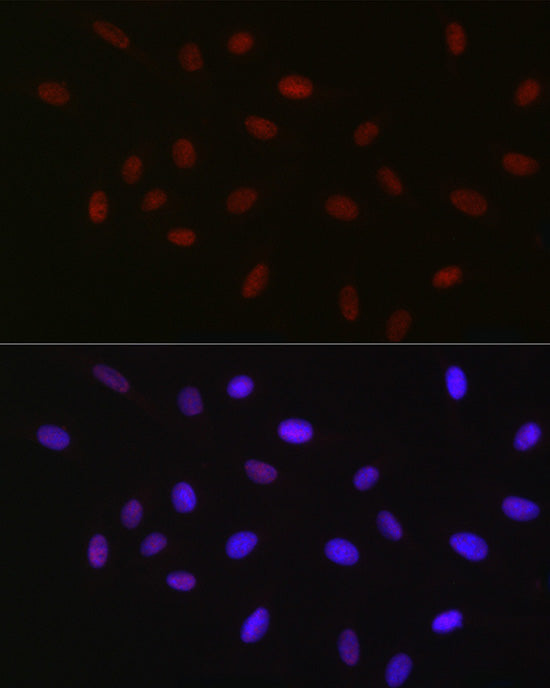 USP39 Rabbit mAb